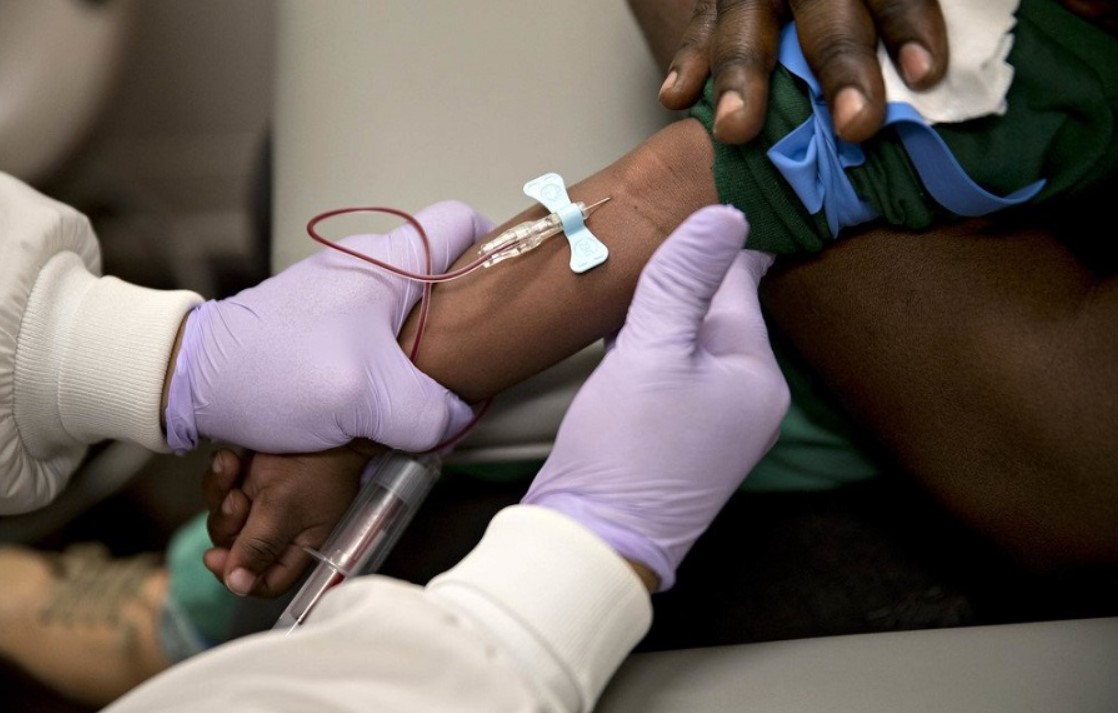 Senate Advances Bill to Establish Sickle Cell Research Centres Nationwide